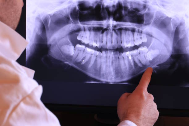 Best Knocked-Out Tooth Emergency  in Cave Spring, VA