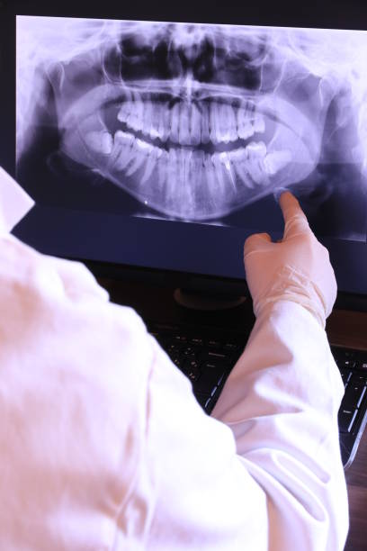 Teeth Whitening in VA
