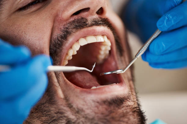 Best Tooth Pain Emergency Relief  in Cave Spring, VA